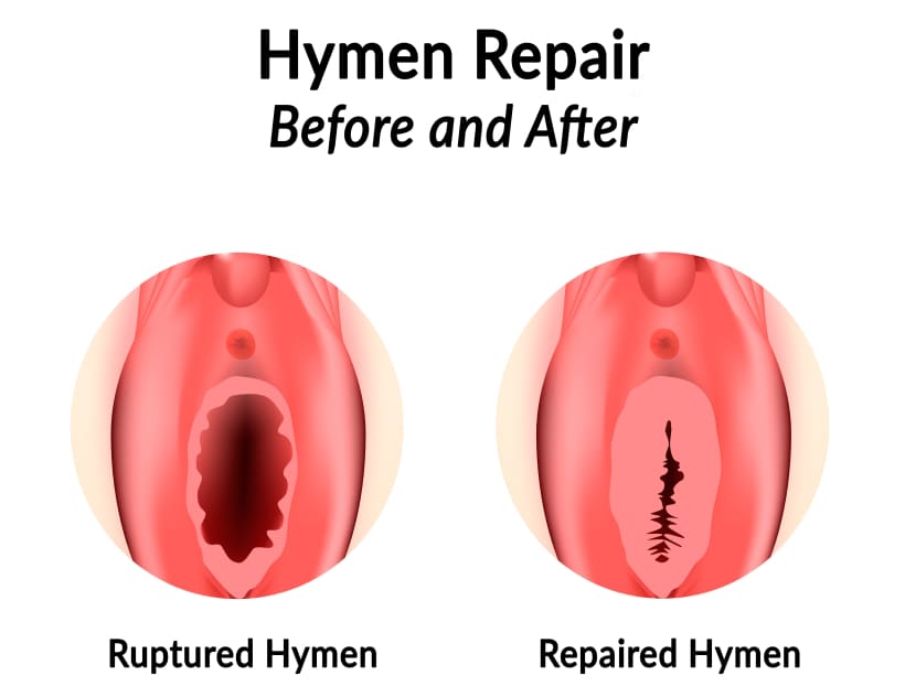 Procedure Details